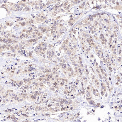 Caspase-2 Recombinant Rabbit mAb (S-3188-3)