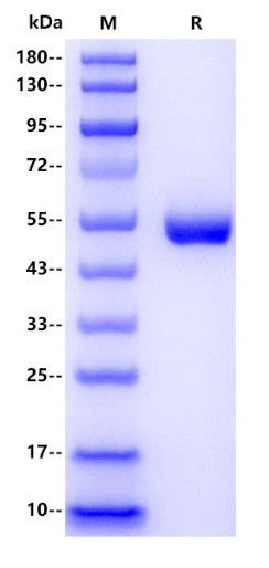 Cathepsin D His Tag Protein, Human