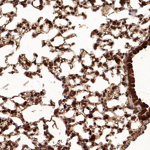 Peroxiredoxin 1/PAG Recombinant Rabbit mAb (S-1673-22)
