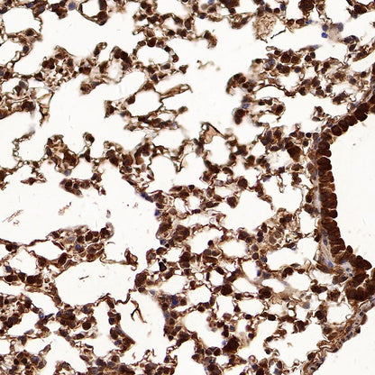 Peroxiredoxin 1/PAG Recombinant Rabbit mAb (S-1673-22)