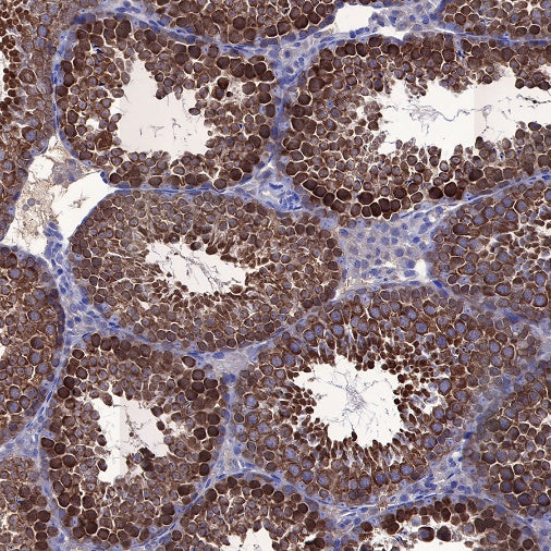 STIP1 Recombinant Rabbit mAb (S-680-39)