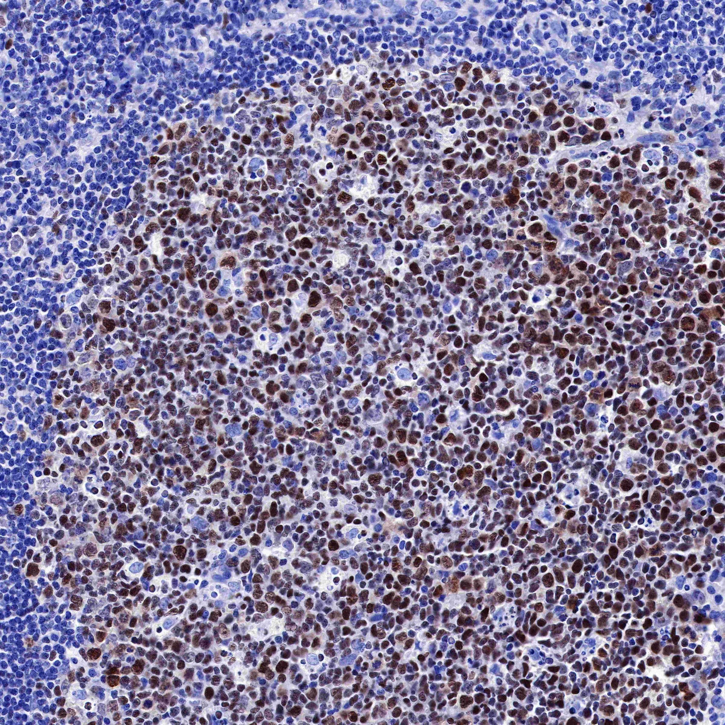 S-RMab® BCL-6 Recombinant Rabbit mAb,PBS Only (SDT-103-21)