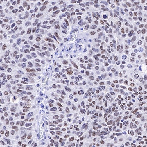 APE Recombinant Rabbit mAb (S-R349)