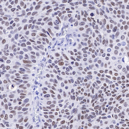 APE Recombinant Rabbit mAb (S-R349)