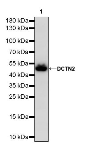 DCTN2 Recombinant Rabbit mAb (S-1082-7)