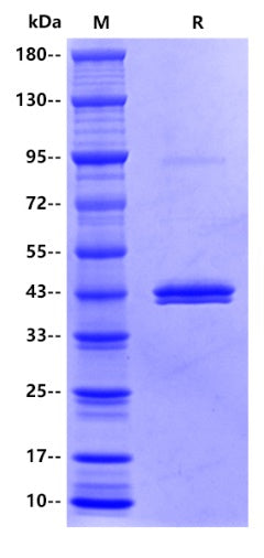 Human IDO1 Protein, His tag
