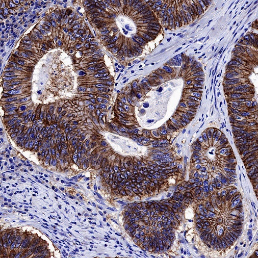 NaK-ATPase Recombinant Rabbit mAb (S-1373-39)