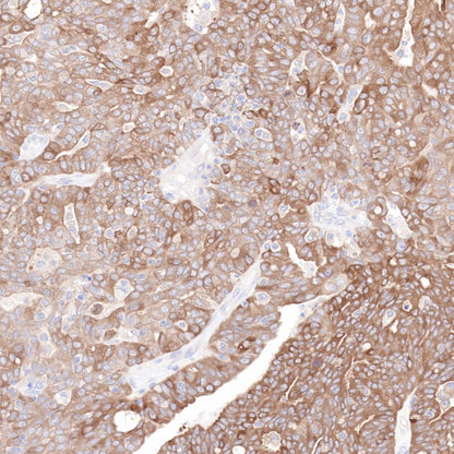 Hsp90 beta Recombinant Rabbit mAb (SDT-R033)