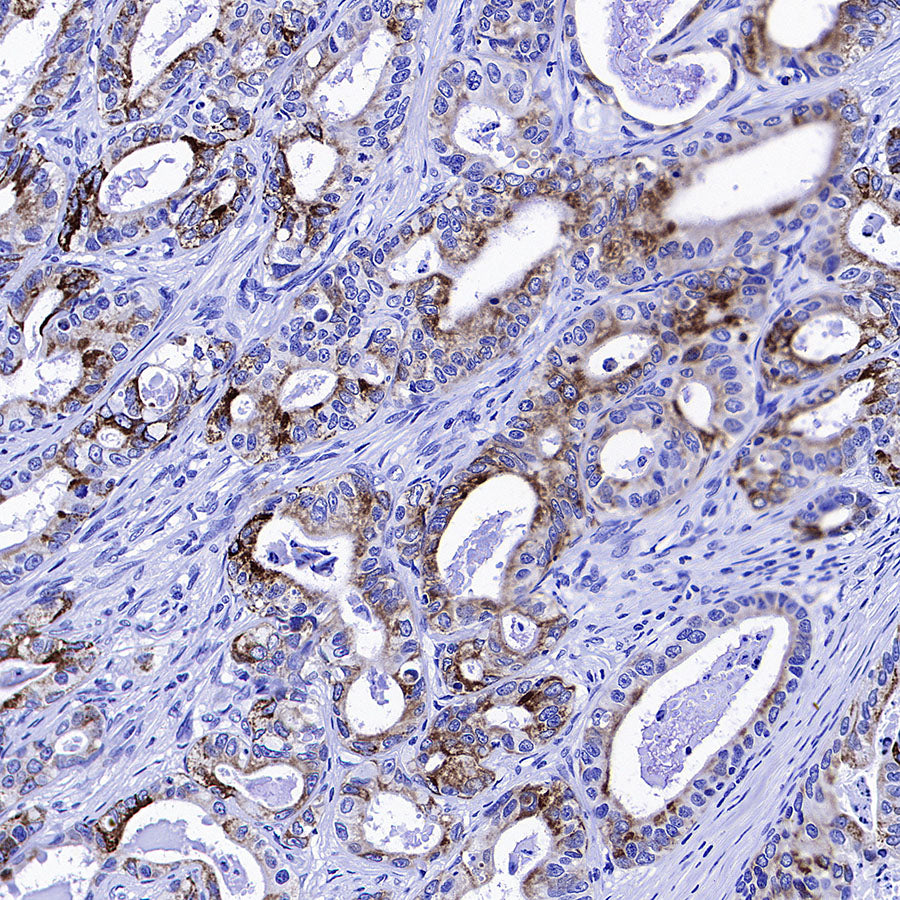Monoamine Oxidase B/MAOB Recombinant Rabbit mAb (S-5317)