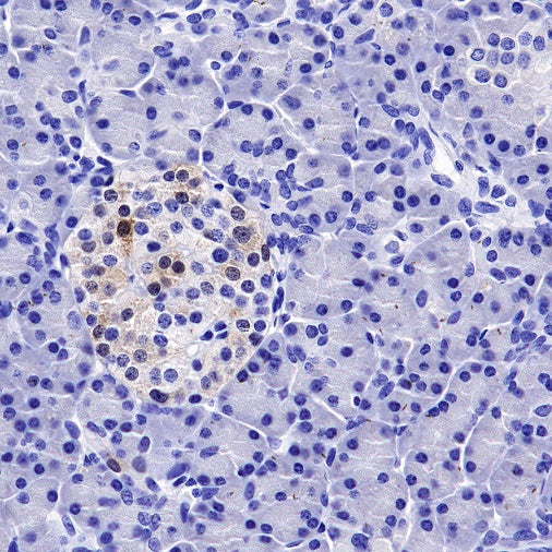 p16 Recombinant Rabbit mAb (SDT-303-206)