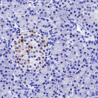 p16 Recombinant Rabbit mAb (SDT-303-206)