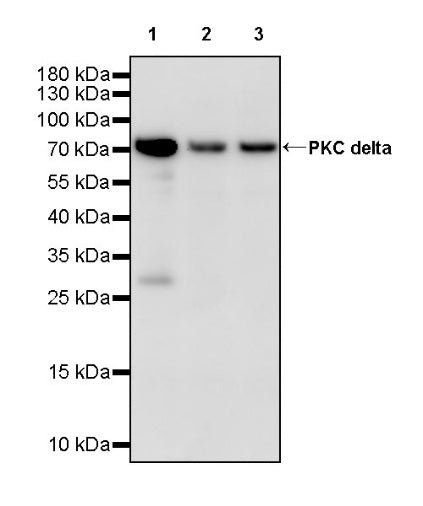 PKC delta Recombinant Rabbit mAb (S-2563-26)