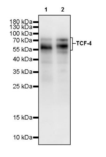 TCF-4 Recombinant Rabbit mAb (SDT-2549-4)