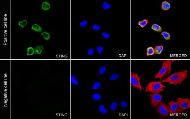 STING Recombinant Rabbit mAb (S-1392-33)