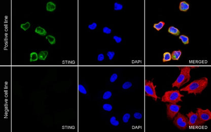 STING Recombinant Rabbit mAb (S-1392-33)