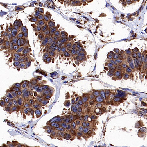 BiP Rabbit Polyclonal Antibody