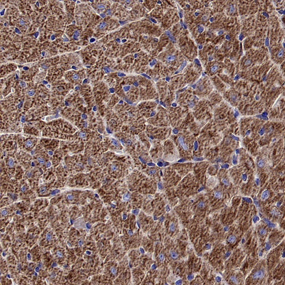SOD2/MnSOD Rabbit Polyclonal Antibody