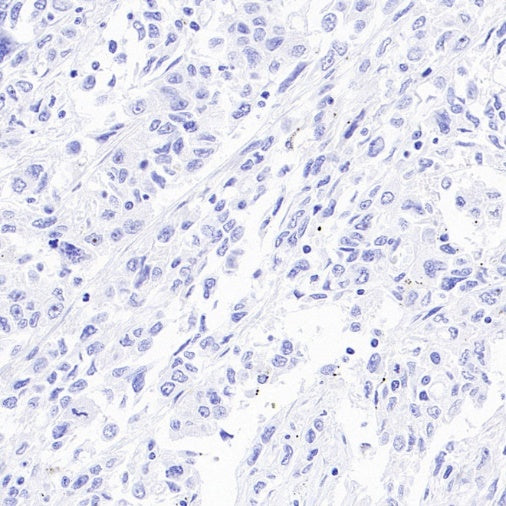 ASCL1/MASH1 Recombinant Rabbit mAb (SDT-3517-121)