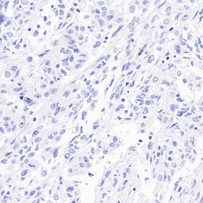ASCL1/MASH1 Recombinant Rabbit mAb (SDT-3517-121)