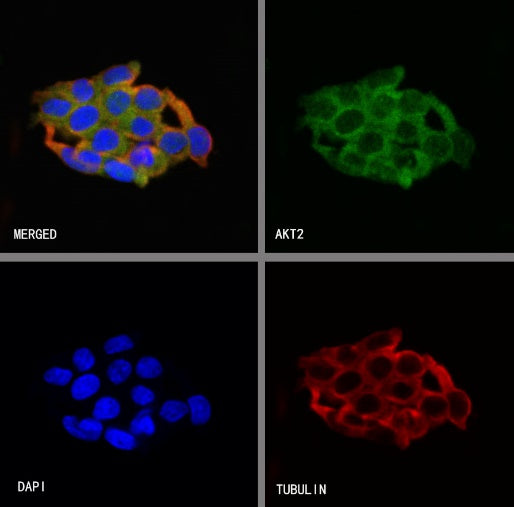 AKT2 Recombinant Rabbit mAb (S-2617-6)