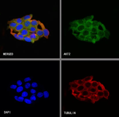 AKT2 Recombinant Rabbit mAb (S-2617-6)
