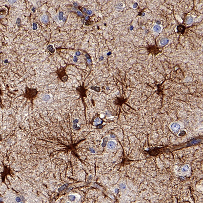 FABP7 Recombinant Rabbit mAb (S-762-41)