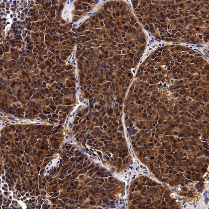 GSK3β Recombinant Rabbit mAb (S-1209-102)