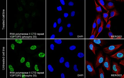 RNA polymerase II CTD repeat YSPTSPS (phospho S5) Recombinant Rabbit mAb (S-2410-79)
