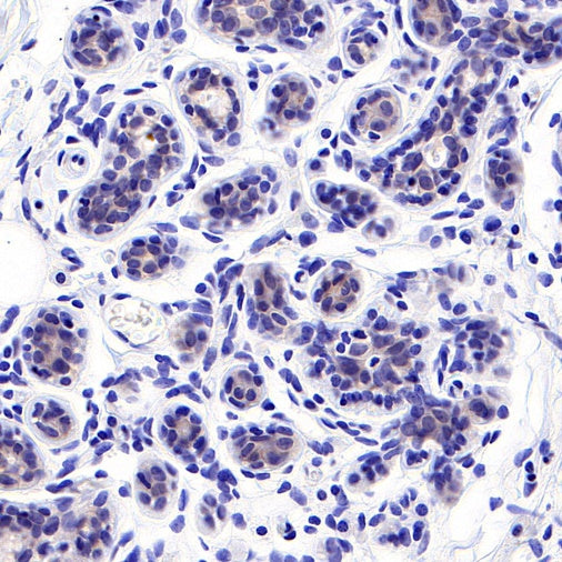 S-RMab® ErbB3 Recombinant Rabbit mAb (SDT-991-10)