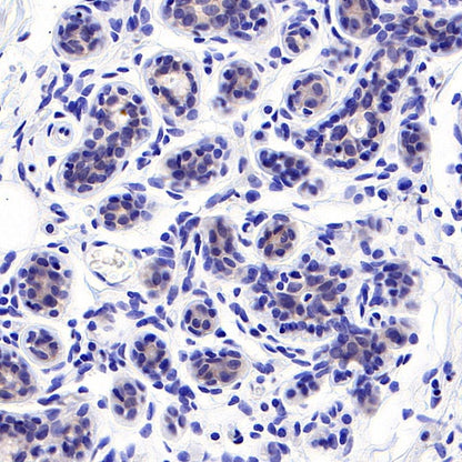 S-RMab® ErbB3 Recombinant Rabbit mAb (SDT-991-10)