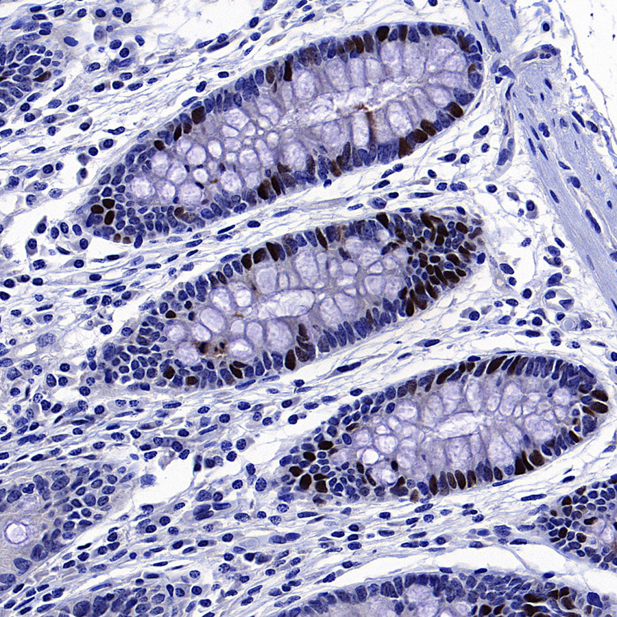 Skp2 Recombinant Rabbit mAb (S-4906)