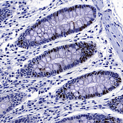 Skp2 Recombinant Rabbit mAb (S-4906)