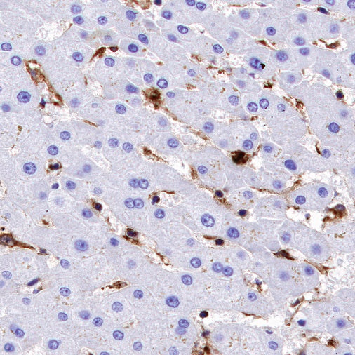 VISTA Recombinant Rabbit mAb (S-1469-72)