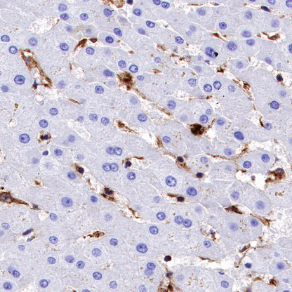 VISTA Recombinant Rabbit mAb (S-1469-72)