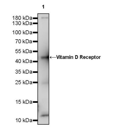 Vitamin D Receptor Recombinant Rabbit mAb (S-1719-7)