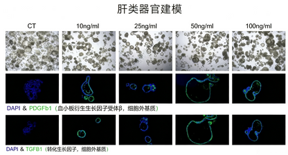 hPSC Induction Differentiation Liver Organoid Kit