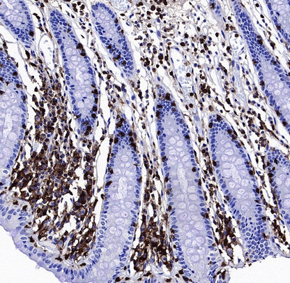 CD45 Recombinant Mouse mAb (S-429-1)