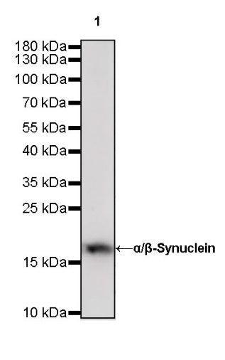 α/β-Synuclein Recombinant Rabbit mAb (S-309-72)