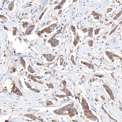 PP2A C Subunit Rabbit polyclonal antibody