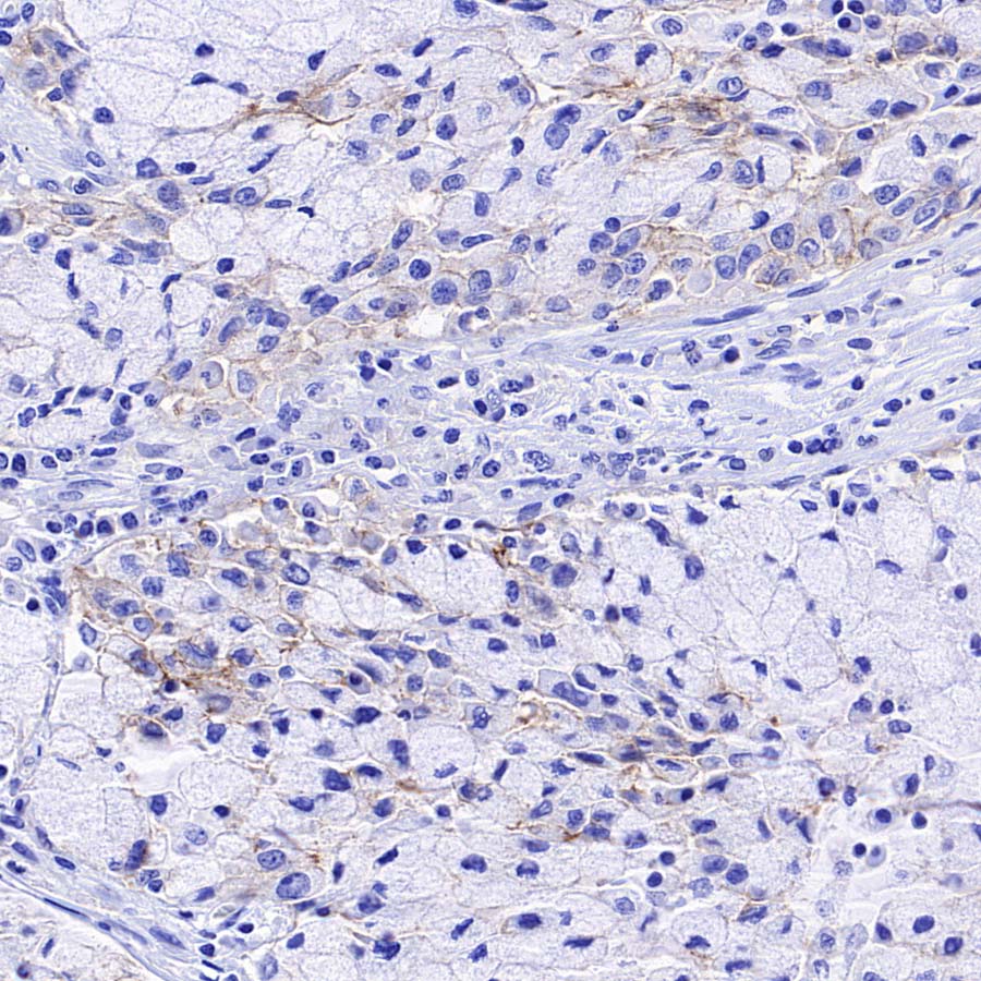 ABCC1/MRP1 Recombinant Rabbit mAb (SDT-4056-11)