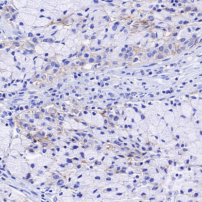 ABCC1/MRP1 Recombinant Rabbit mAb (SDT-4056-11)