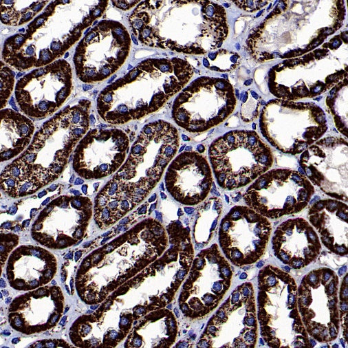 SOD2/MnSOD Rabbit Polyclonal Antibody