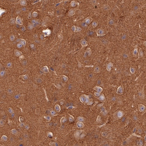 p38 MAPK Recombinant Rabbit mAb (S-508-19)