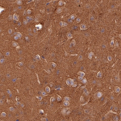 p38 MAPK Recombinant Rabbit mAb (S-508-19)