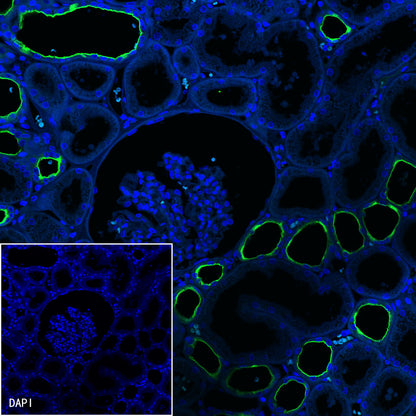 S-RMab® MUC1/EMA Recombinant Rabbit mAb (SDT-776-49)
