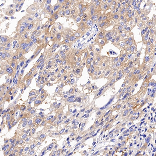 VPS35 Recombinant Rabbit mAb (S-997-2)