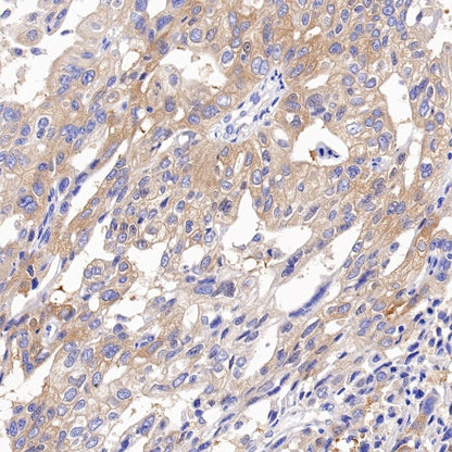 VPS35 Recombinant Rabbit mAb (S-997-2)