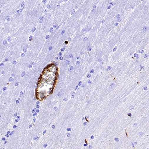 S-RMab®CD4 Recombinant Rabbit mAb (S-R569)