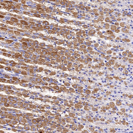 SDHB Recombinant Rabbit mAb (SDT-1162-2)