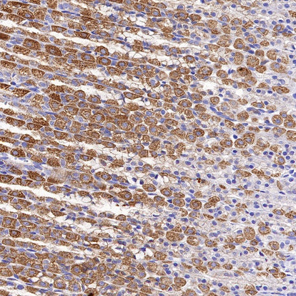 SDHB Recombinant Rabbit mAb (SDT-1162-2)